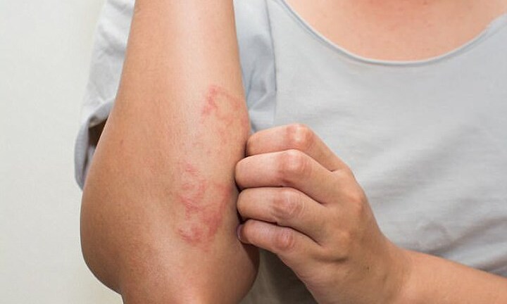 Cảnh giác các loại bệnh có nguy cơ lây nhiễm từ bể bơi công cộng cho người mê bơi lội