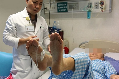 Phẫu thuật loại bỏ khối u màng não khổng lồ cho bà cụ 76 tuổi