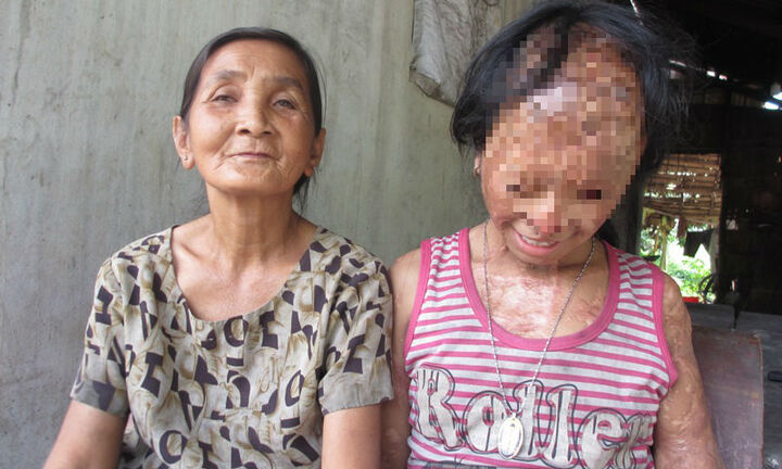 Bà nội của bé gái bị tạt axít đã đến tòa xin đôi mắt tử tù Nguyễn Hữu Tình