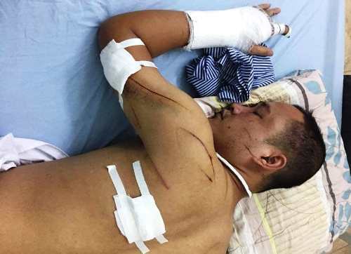 Hải Phòng: Điều tra vụ chủ đầm tôm bị chủ tàu cát lậu chém nguy kịch