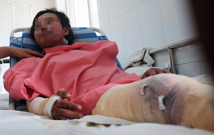 Tin tức đời sống mới nhất ngày 1/8/2018: Hai mẹ con suýt chết vì nuốt rết sống chữa bệnh