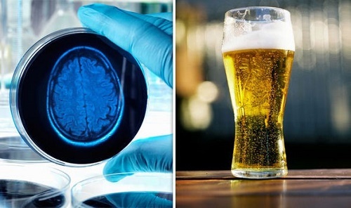 Nghiên cứu 30 năm: Không uống rượu bia dễ... mất trí nhớ