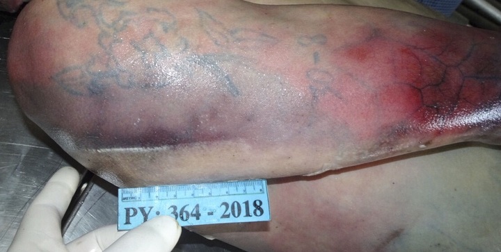 Tìm người nhà bệnh nhân đã tử vong, trên bả vai xăm hình cành hoa hồng