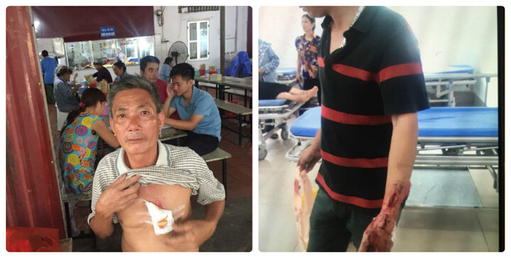 Hà Nội: 5 người cùng nhà bị truy sát phải nhập viện