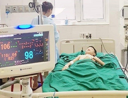 Bé trai 11 tuổi nguy kịch vì ong vò vẽ đốt hơn 100 nốt