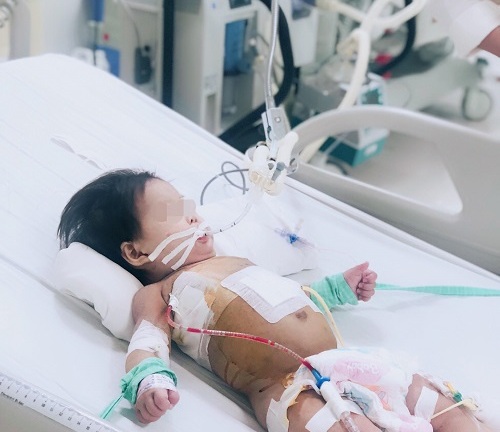 Đau lòng bé gái 20 tháng tuổi tróc da toàn thân bỏng nước sôi trong ấm đun siêu tốc