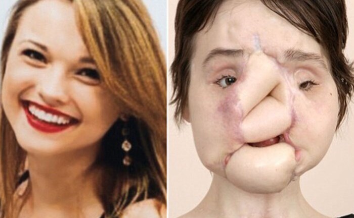 Thiếu nữ 21 tuổi 