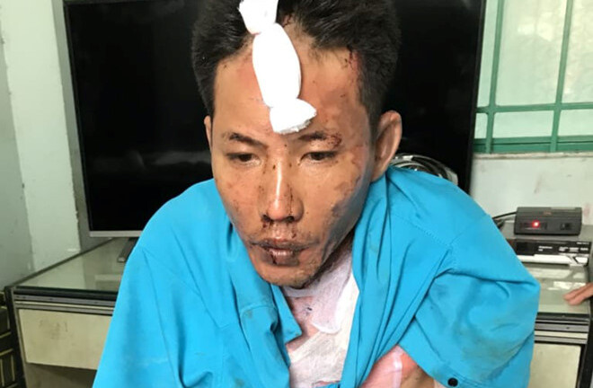 Bắt giữ đối tượng đốt vợ và hai con nhỏ