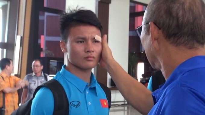 Video: Quang Hải phụng phịu để thầy Park dán lại vết thương ở mắt