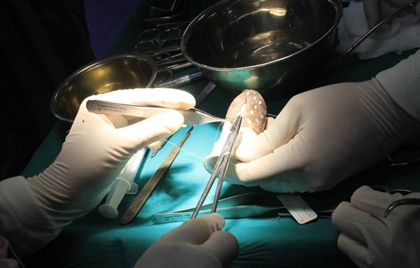 Sau cuộc hôn nhân đổ vỡ, cô gái bẩm sinh khuyết âm đạo đi phẫu thuật tạo hình