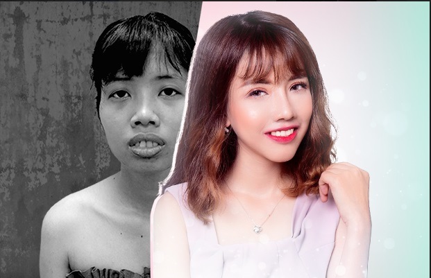 Thẩm mỹ viện Đông Á - Giải mã lý do đây là địa chỉ