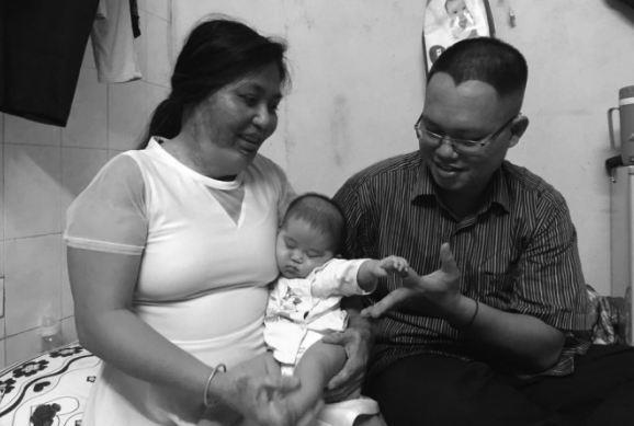 Chuyện tình như mơ của cô gái 32 lần phẫu thuật chằng chịt sẹo