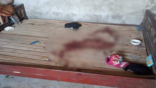 Bé gái 11 tuổi bị bố cứa cổ vì muốn đi tập múa văn nghệ Trung thu