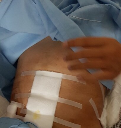 Thanh Hóa: Vụ côn đồ truy sát 2 bố con tại tiệm bánh trung thu khiến dư luận phẫn nộ