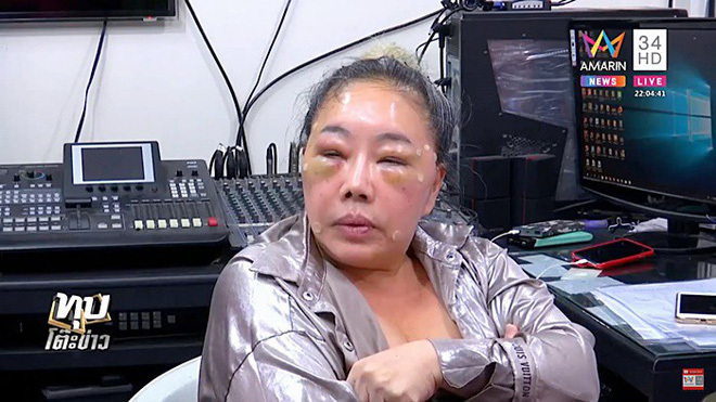 Sự thật việc nữ đại gia 60 tuổi ở Thái Lan bị đánh sưng vù mặt