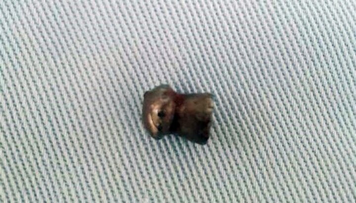 Nguyên nhân bất ngờ vụ nam thanh niên trúng đạn khi làm vườn