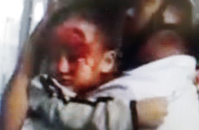 Cha ôm con 3 tuổi máu chảy đầm đìa mỏi mắt tìm bác sĩ trong bệnh viện