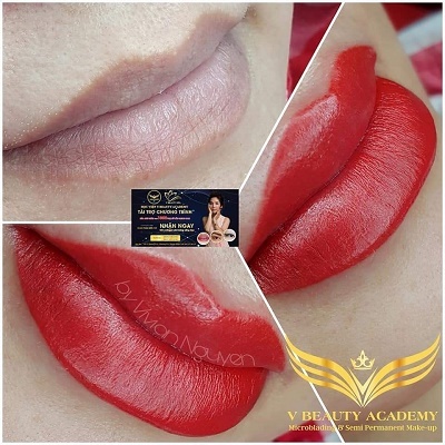 Chương trình xóa môi thâm cho 1000 phụ nữ Bắc Trung Nam