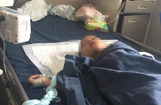 Vụ 3 mẹ con uống thuốc diệt cỏ: Bé trai 4 tuổi tử vong