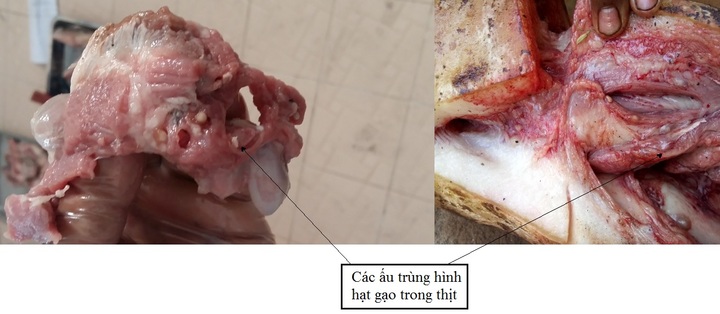 Ăn món khoái khẩu từ thịt lợn, thịt bò tái: Sán dây “tấn công” lên não nguy kịch
