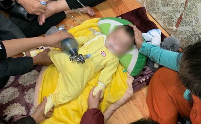 Tin tức đời sống mới nhất ngày 21/11/2018: Chồng tiêm filler làm mù mắt vợ