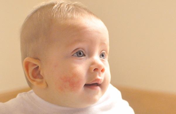 Cách chăm sóc da bé vào mùa đông