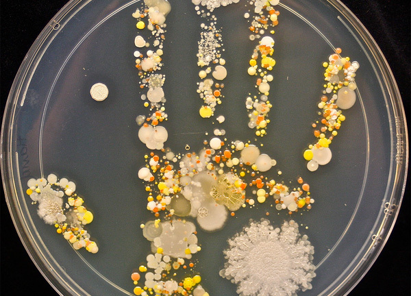 Mùa lạnh: Bị viêm phổi, tử vong chỉ vì... tay bẩn