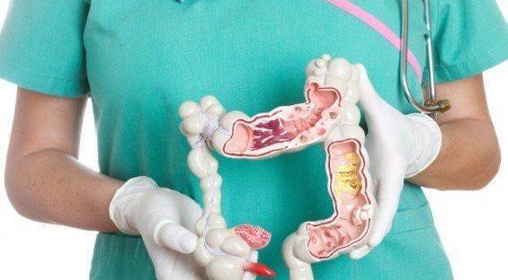 Điểm mặt 3 sai lầm khiến người viêm đại tràng không bao giờ thoát khỏi