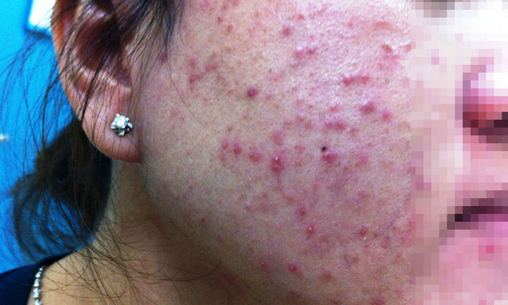 Nữ sinh 19 tuổi nhận