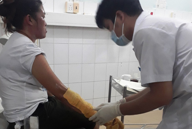 Bình gas mini phát nổ trong lúc ăn đêm ở Phú Quốc, 7 du khách bị bỏng