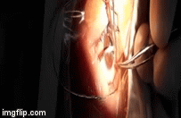 Video: Rùng mình chứng kiến cảnh bác sĩ rút chiếc đinh cắm sâu trong mắt bệnh nhân