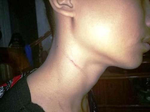 Hiệu trưởng bị tố bóp cổ học sinh chỉ vì hát trong lớp: Công an vào cuộc xác minh