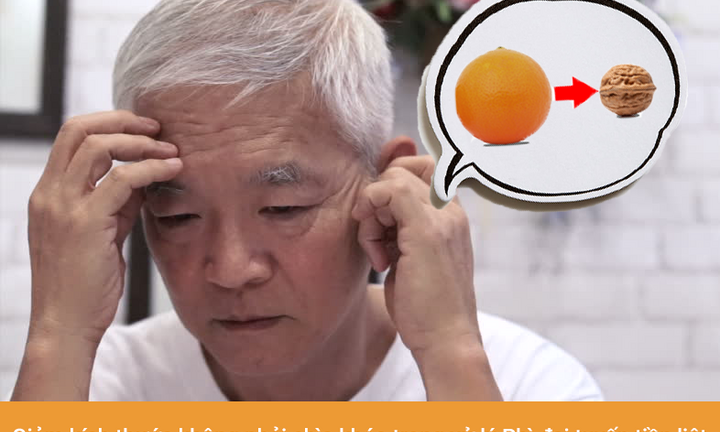 Đừng hiểu sai về giảm kích thước trong giải quyết Phì đại tuyến tiền liệt