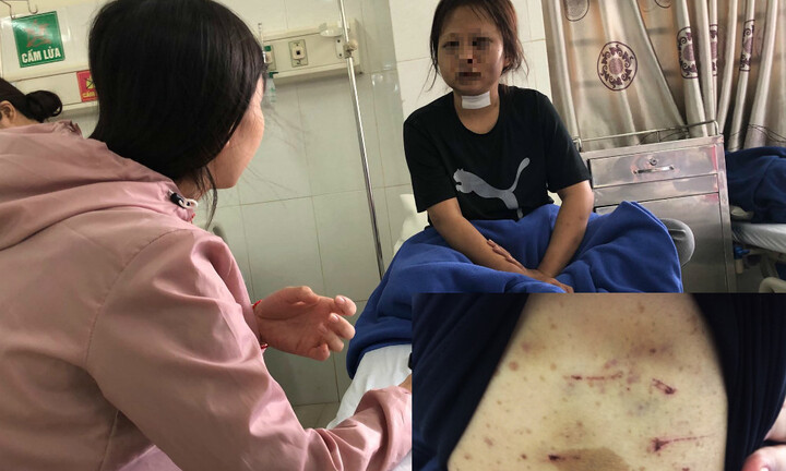 Thiếu nữ 17 tuổi trốn khỏi 