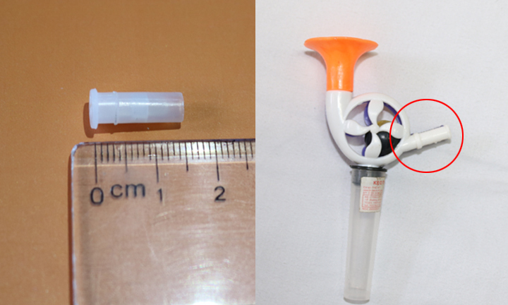 Hóc kèn đồ chơi, bé trai 6 tuổi ngưng thở, ngưng tim suýt chết