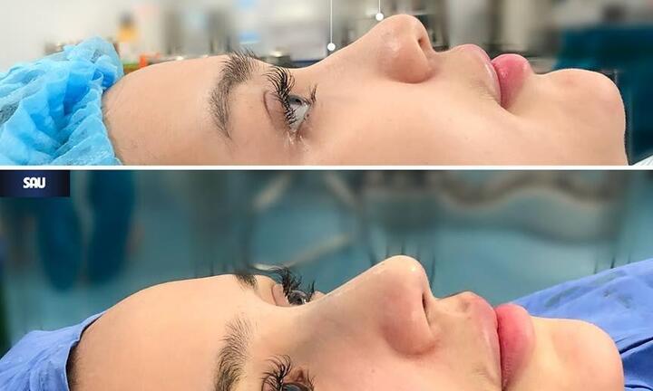 Thẩm mỹ quốc tế VQ giới thiệu những dịch vụ thẩm mỹ đỉnh cao năm 2019