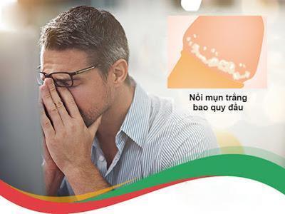 Hiện tượng nổi mụn trắng ở bao quy đầu, nguyên nhân và cách khắc phục