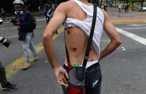 Biểu tình bùng phát gây bạo loạn tại Venezuela, 26 người thiệt mạng