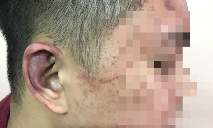 (Bài 3) Luật sư nói gì vụ công ty Hà Huy trả lương nhân viên bằng “Nắm đấm”