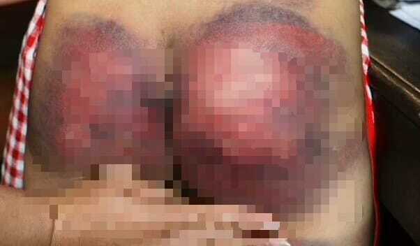 Công an xác minh vụ bé gái 8 tuổi nghi bị bố trói tay vào cột đánh đập