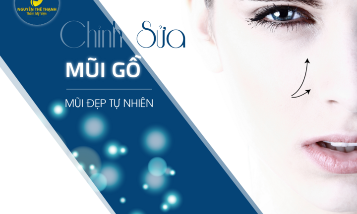 Chỉnh sửa mũi gồ - Mũi đẹp tự nhiên