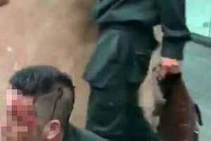 4 bảo vệ quán bar ở đất Cảng bị nhóm người lạ hành hung trong đêm