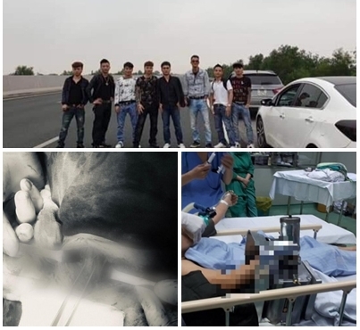 Tin tức đời sống ngày 10/3/2019: Thanh niên 9X bị đâm thấu cổ được cứu sống