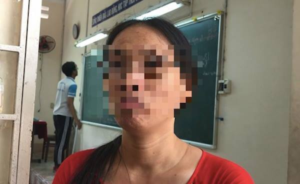 Cô giáo “im như thóc” lại bị đình chỉ vì ném vở học sinh