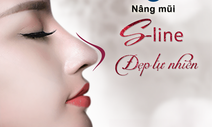 Nâng mũi cấu trúc S-Line - Mũi cao đẹp tự nhiên