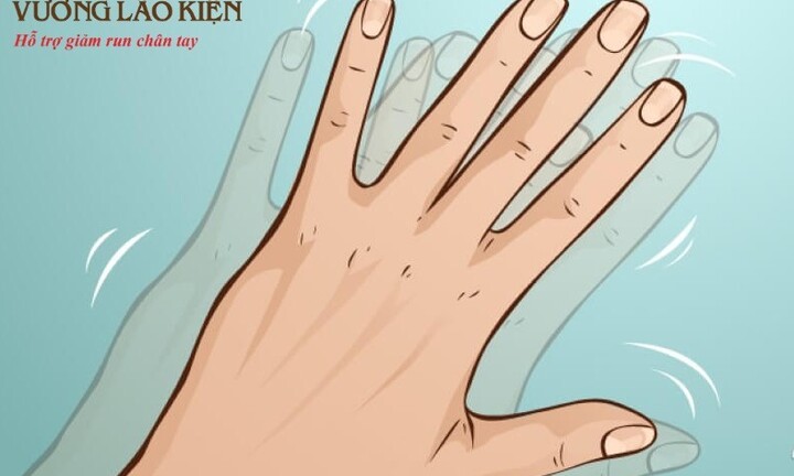 Có hiện tượng run tay chân cần ngay lập tức đi khám vì lý do sau