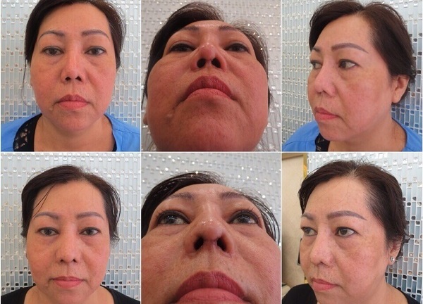 Bác sĩ Lê Văn Sẽ - Địa chỉ cứu cánh của những ca phẫu thuật hỏng