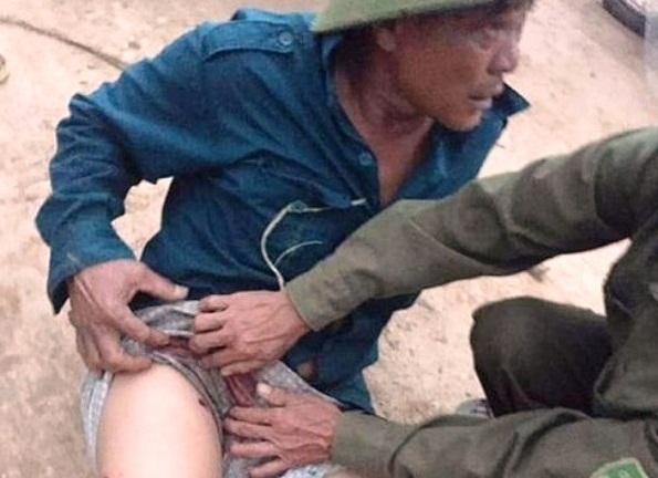 Vụ nhóm đối tượng đi ô tô rút súng bắn trọng thương người dân: Tạm giữ một nghi phạm