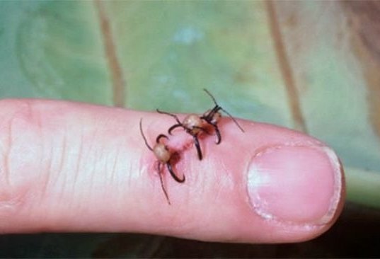 Các phương pháp trị bệnh