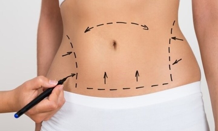 Cô gái tử vong khi đi thẩm mỹ hút mỡ bụng 